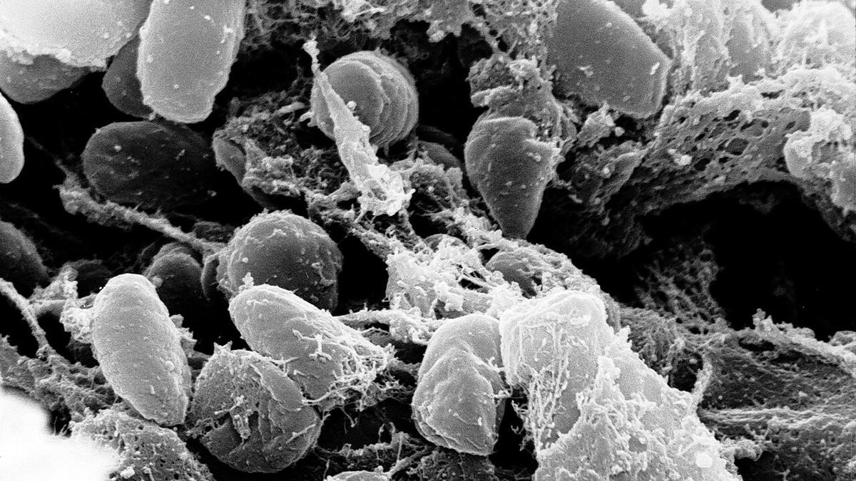 Pandemic Waves in New York How Diseases Reshaped the City and Altered the Course of History for Generations to Come in Unforeseen Ways