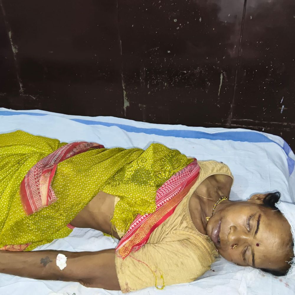घंसौर में वाहन की टक्कर से बाइक सवार महिला की अस्पताल में मौत, चालक फरार