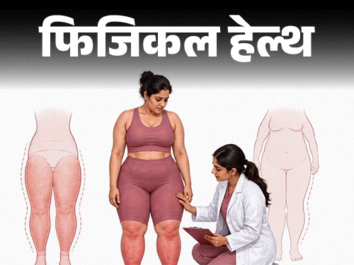 कमर-जांघों की चर्बी: लिपेडेमा के लक्षण, इलाज और बचाव के तरीके जानें डॉक्टर से