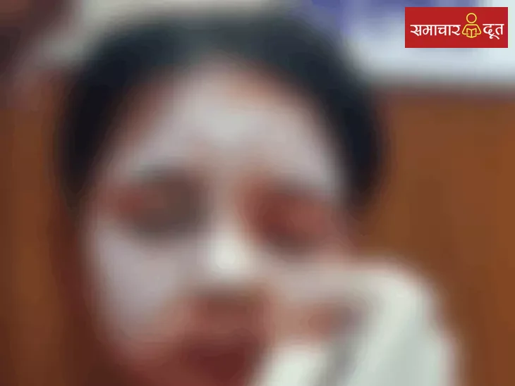लव-प्रपोजल ठुकराया तो छात्रा पर एसिड अटैक करवाया 