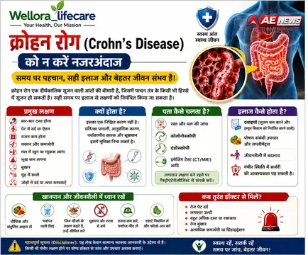 पेट के इन संकेतों को न करें नजरअंदाज, जानें क्रोहन रोग के लक्षण, कारण और इलाज