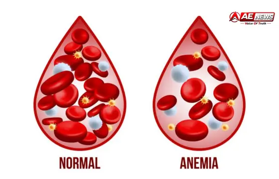 एनीमिया (खून की कमी / Anemia) – शरीर में ऑक्सीजन की कमी का एक प्रमुख कारण