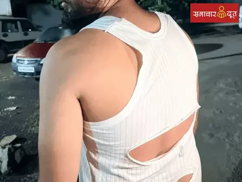 बिलासपुर में बस एजेंट के साथ गुंडागर्दी: रंगदारी न देने पर हिस्ट्रीशीटर ने की मारपीट, पुलिस कार्रवाई पर उठे सवाल